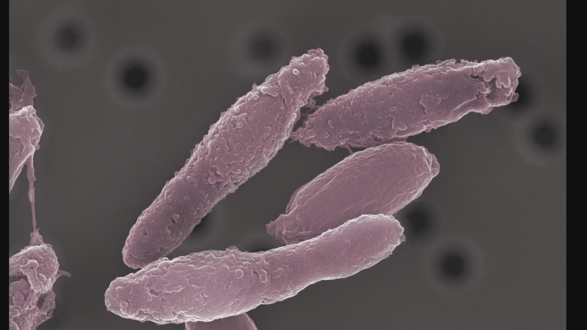 "Clostridium" captured with an electron microscope  